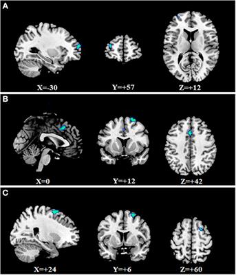 Common and Specific Functional Activity Features in Schizophrenia, Major Depressive Disorder, and Bipolar Disorder